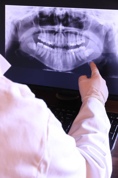 Best Emergency Treatment for Oral Infections in Mukilteo, WA